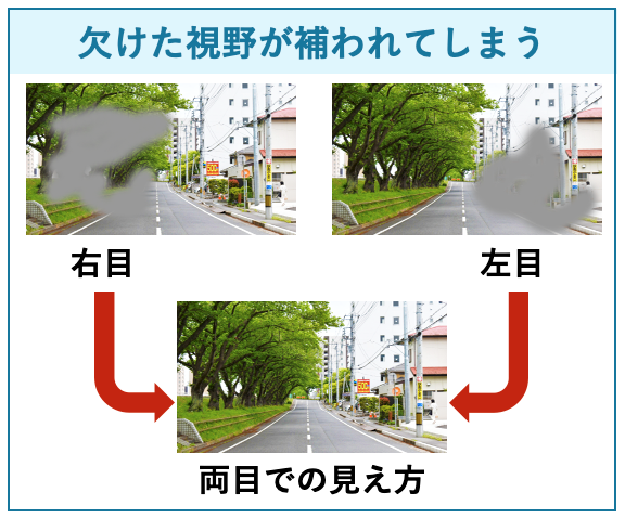 欠けた視野が補われてしまう 欠けた視野が補われてしまう